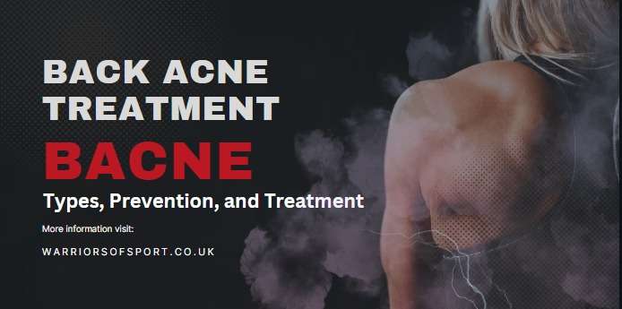 back acne treatment